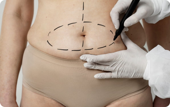 Cirugía de abdomen